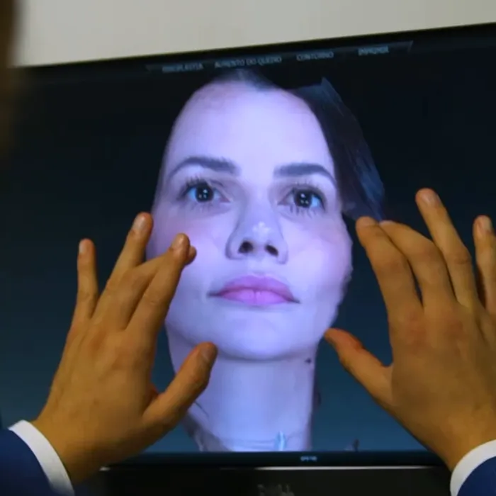 Rosto de paciente em 3D na tela do Vectra, durante a simulação
